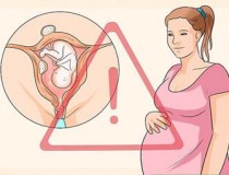 Bệnh u xơ tử cung khi mang thai