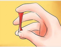 Khí hư có máu ra kèm theo là bệnh gì?