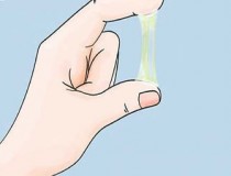 Khí hư màu vàng xanh là biểu hiện của bệnh gì?