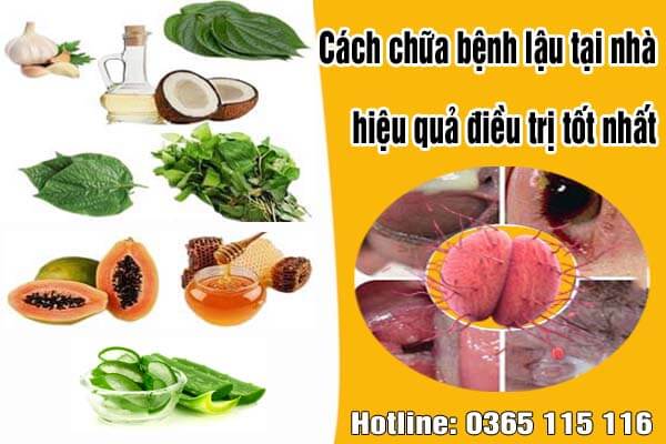 Cách Chữa Bệnh Lậu Tại Nhà Hiệu Quả - Phương Pháp An Toàn, Dễ Thực Hiện